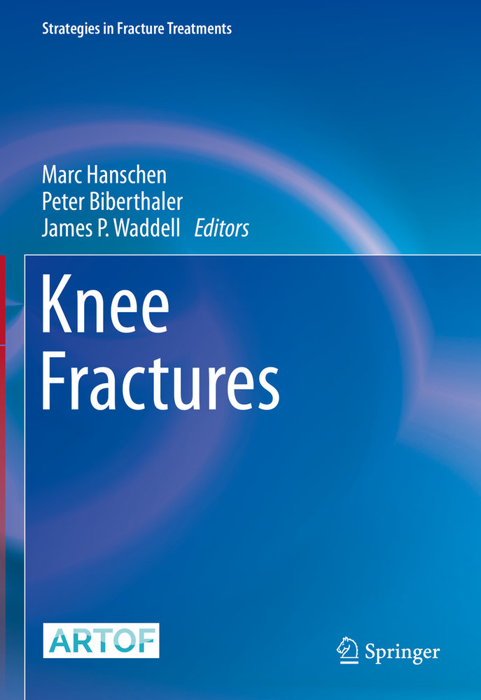 Knee Fractures