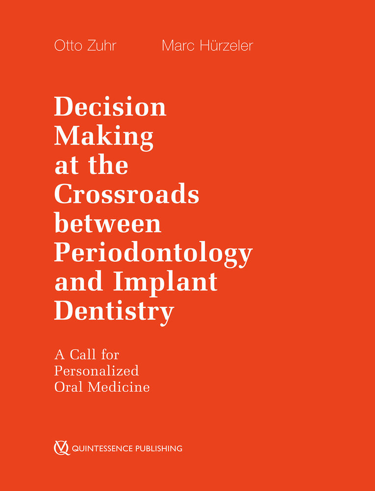 Decision Making at the Crossroads between Periodontology and Implant Dentistry