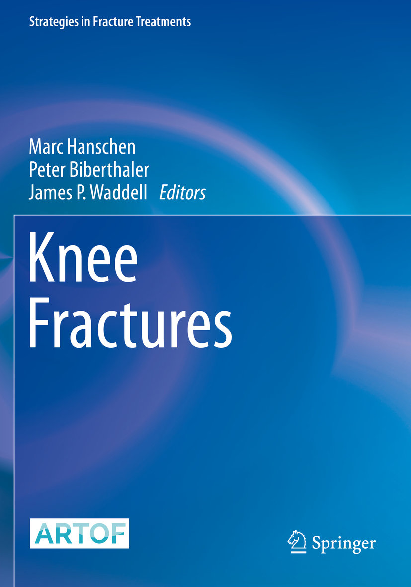 Knee Fractures