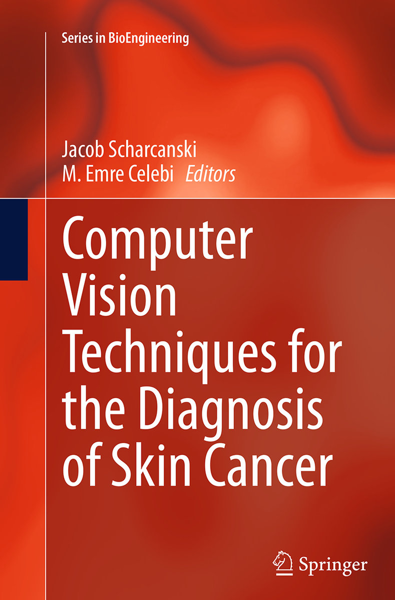 Computer Vision Techniques for the Diagnosis of Skin Cancer