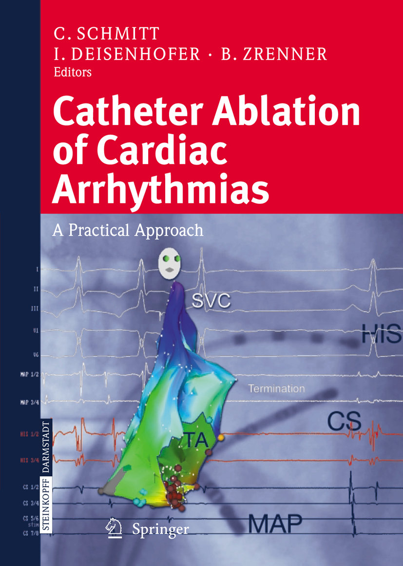 Catheter Ablation of Cardiac Arrhythmias