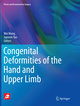 Congenital Deformities of the Hand and Upper Limb